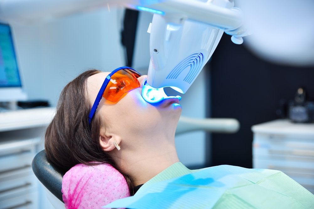 In-clinic teeth whitening session, showing why supervised whitening is safe