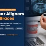 Clear aligners vs braces | guide by Zoom Dental Clinic in Tabarbour