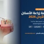 تكلفة زراعة الأسنان في الأردن 2026 من عيادة زووم لطب الأسنان