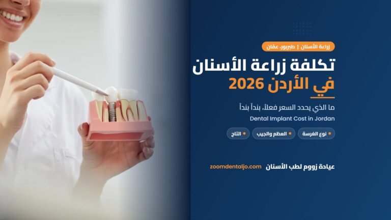 تكلفة زراعة الأسنان في الأردن 2026 من عيادة زووم لطب الأسنان