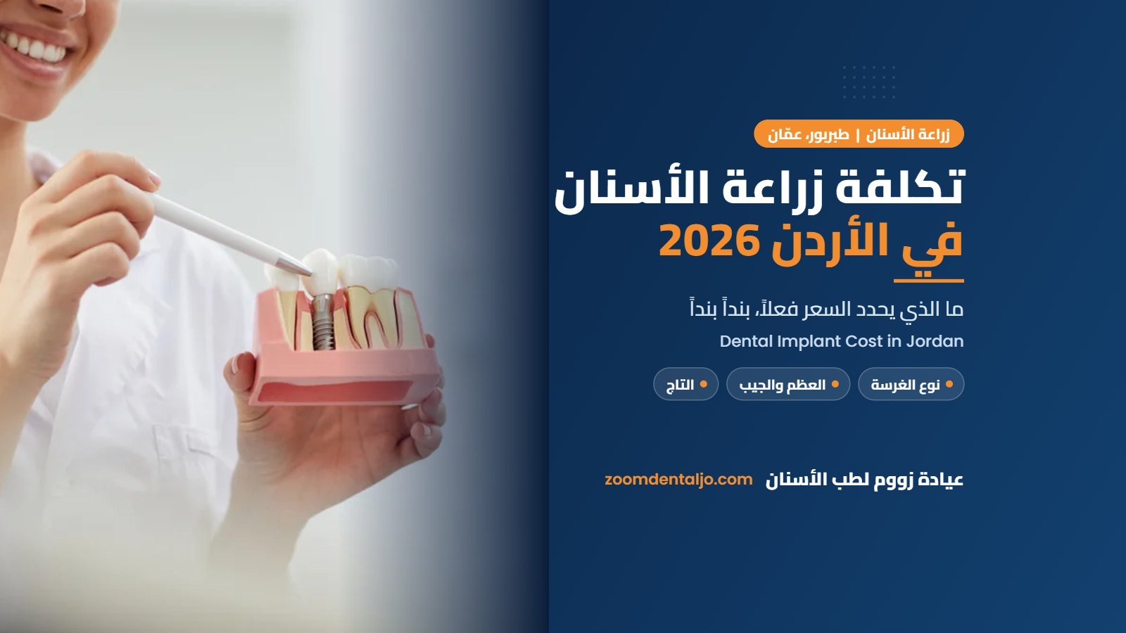تكلفة زراعة الأسنان في الأردن 2026 من عيادة زووم لطب الأسنان