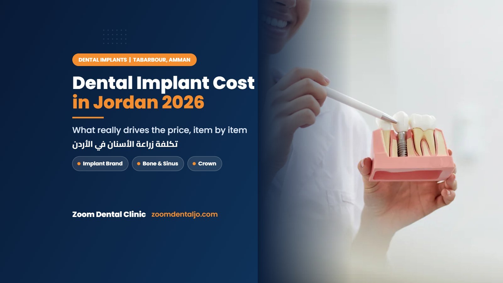Dental implant cost in Jordan 2026 guide by Zoom Dental Clinic