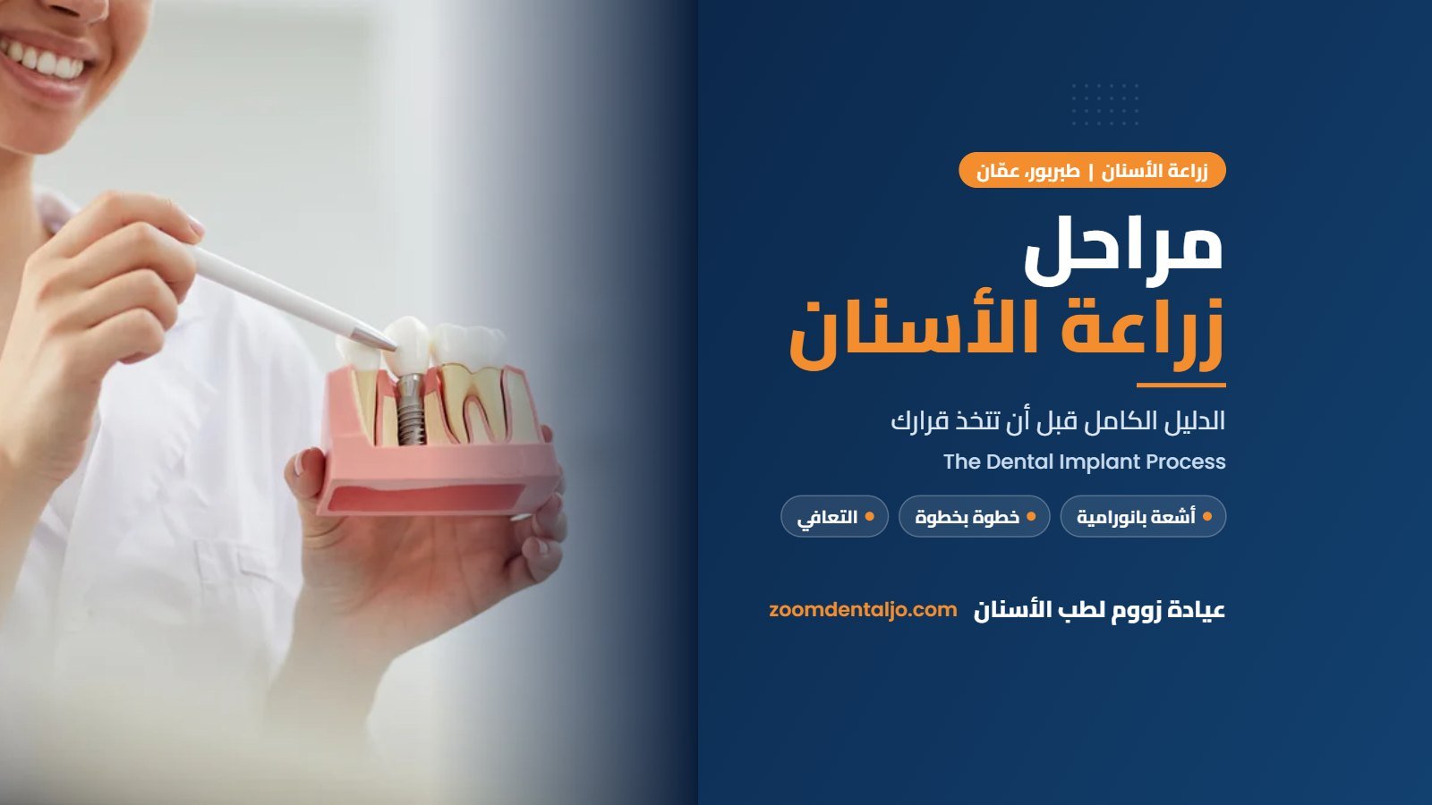 مراحل زراعة الأسنان | دليل عيادة زووم لطب الأسنان في طبربور