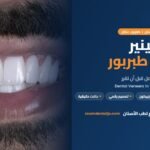 الفينير في طبربور | دليل عيادة زووم لطب الأسنان في طبربور