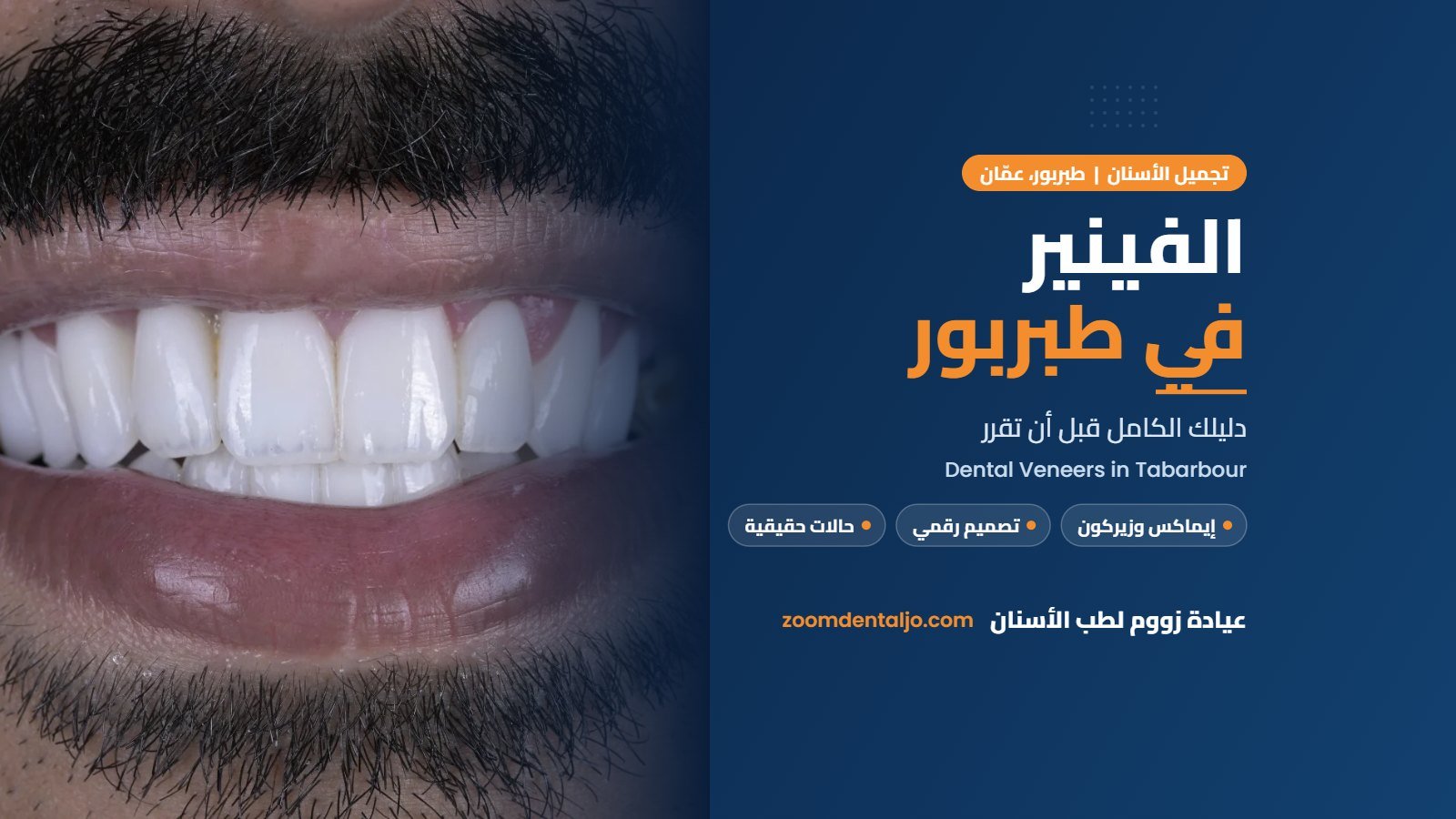 الفينير في طبربور | دليل عيادة زووم لطب الأسنان في طبربور