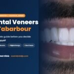 Dental veneers in Tabarbour | guide by Zoom Dental Clinic in Tabarbour