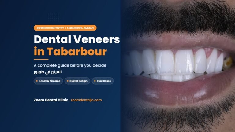 Dental veneers in Tabarbour | guide by Zoom Dental Clinic in Tabarbour