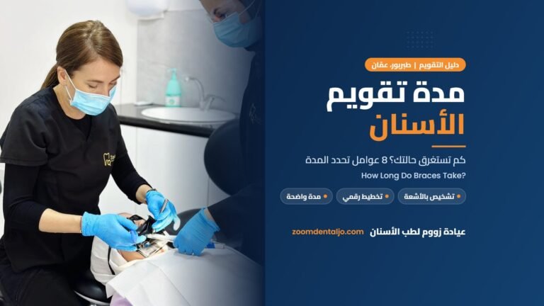 مدة تقويم الأسنان | دليل عيادة زووم لطب الأسنان في طبربور