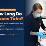 How long do braces take | guide by Zoom Dental Clinic in Tabarbour