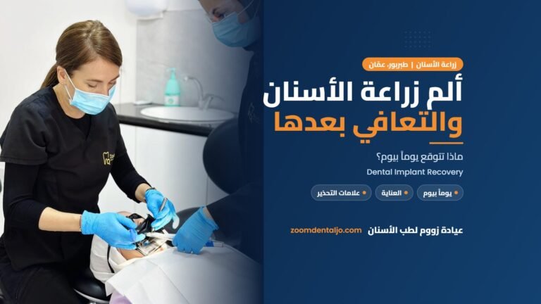 ألم زراعة الأسنان والتعافي بعدها: دليل عيادة زووم لطب الأسنان