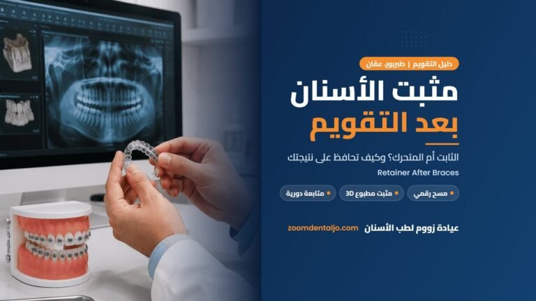 مثبت الأسنان بعد التقويم | دليل عيادة زووم لطب الأسنان في طبربور