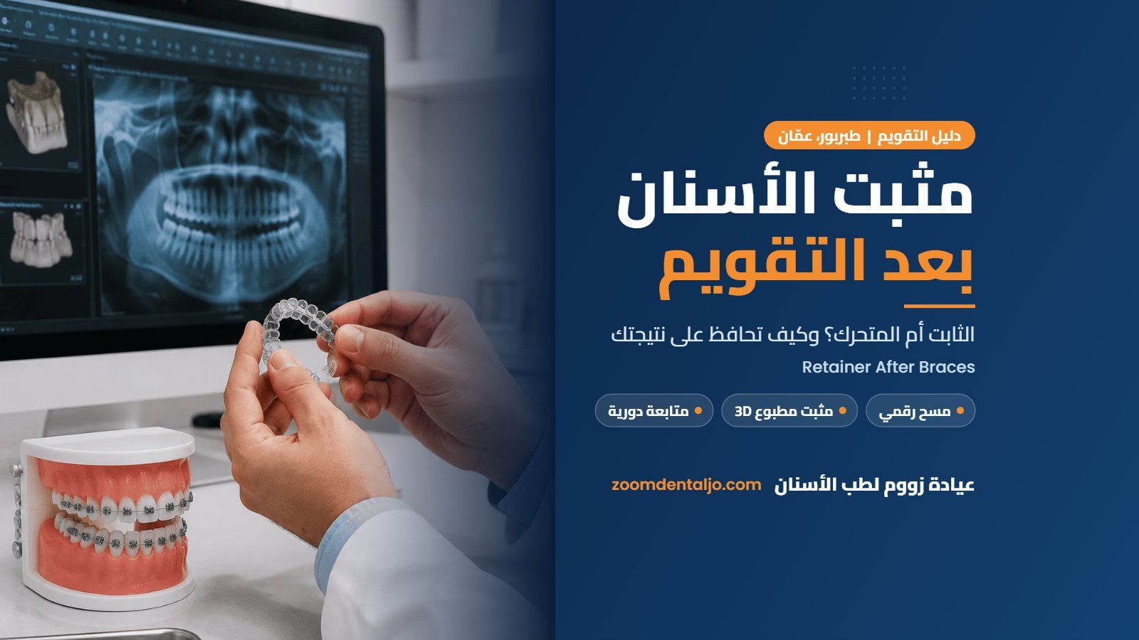 مثبت الأسنان بعد التقويم | دليل عيادة زووم لطب الأسنان في طبربور