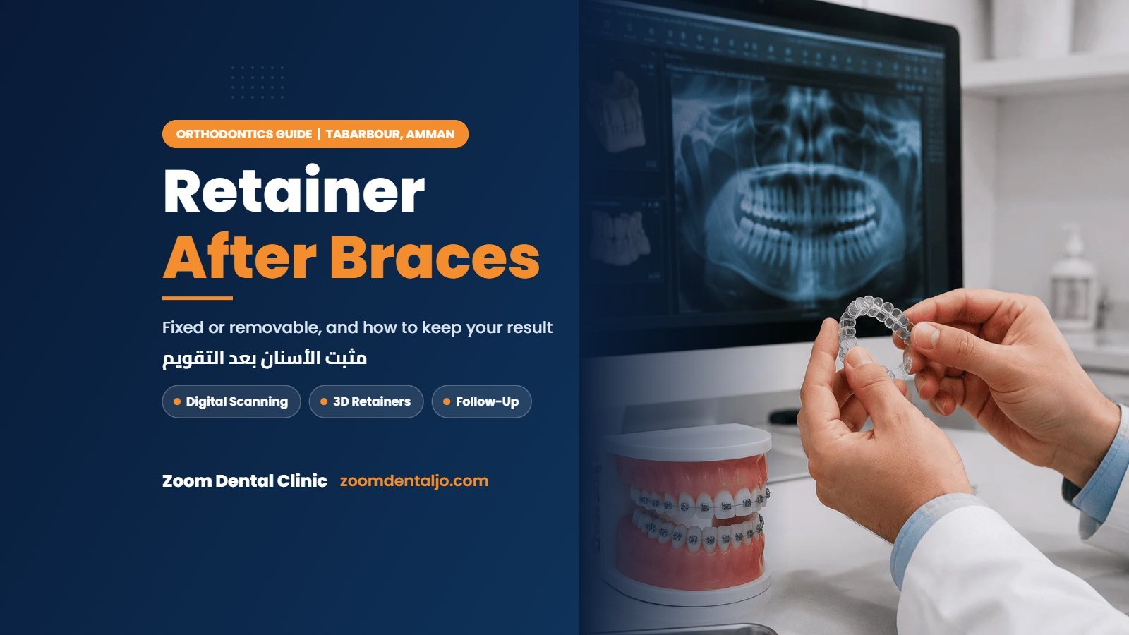 Retainer after braces | guide by Zoom Dental Clinic in Tabarbour