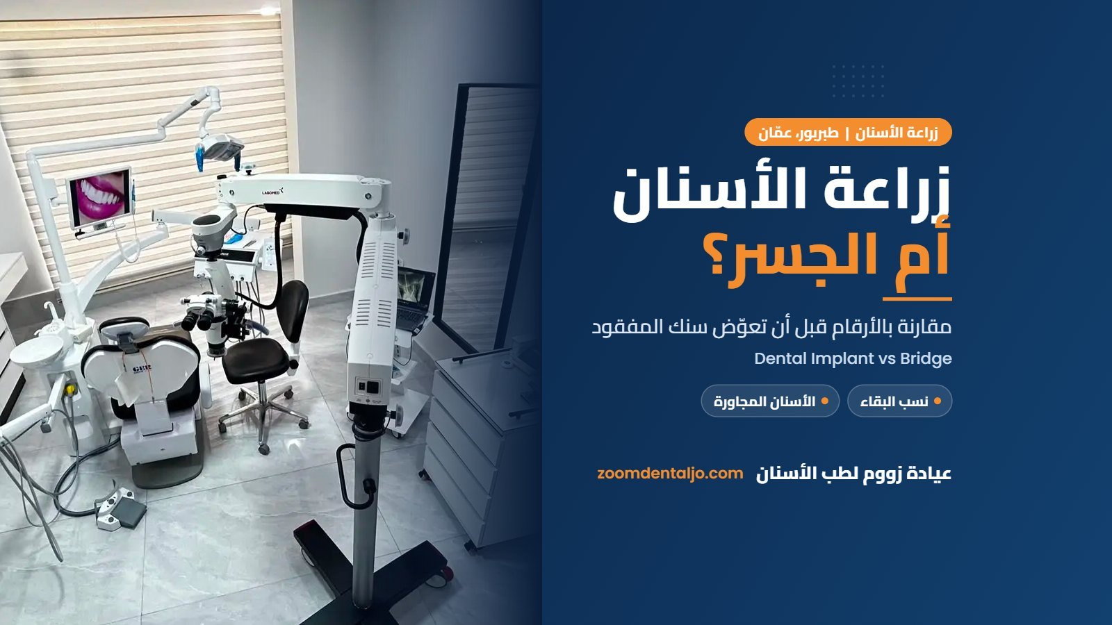 زراعة الأسنان أم الجسر: مقارنة من عيادة زووم لطب الأسنان