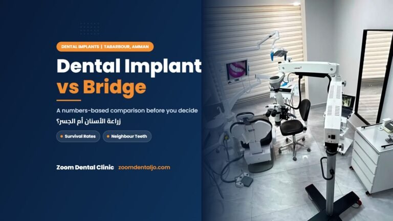 Dental implant vs bridge comparison by Zoom Dental Clinic
